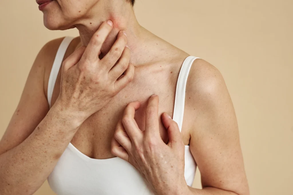 close-up-of-woman-scratching-neck-itch-and-allergi-2023-10-31-05-33-36-utc