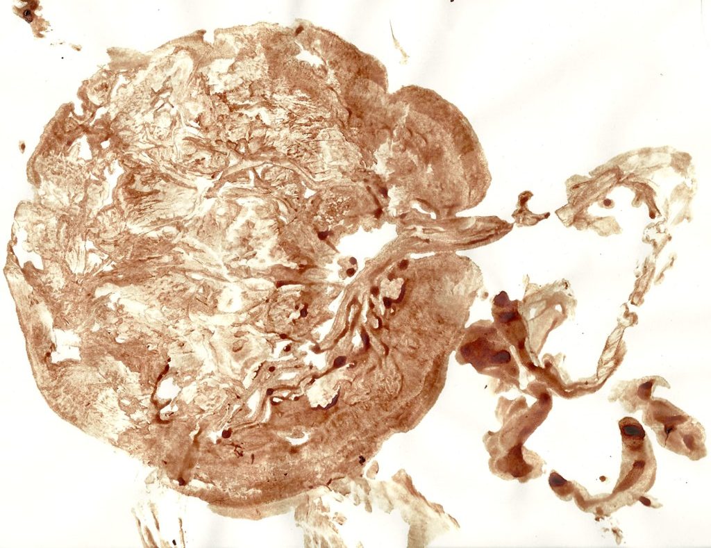 Placenta print